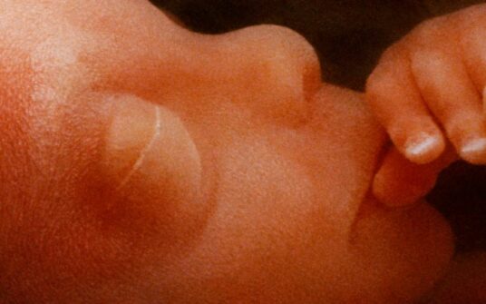 Fundacja Grupa Proelio: ustawa o dekryminalizacji aborcji to de facto aborcja na życzenie